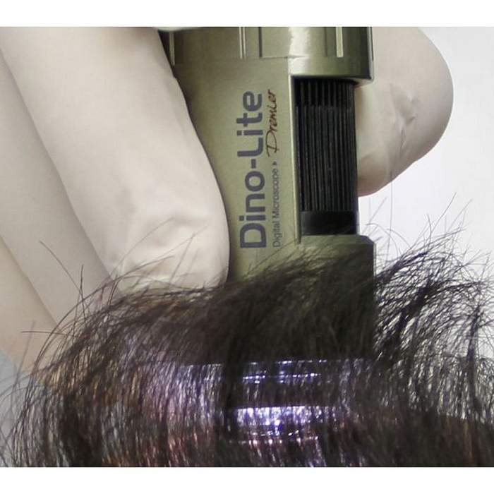 Поляризатор Dino-Lite TrichoScope