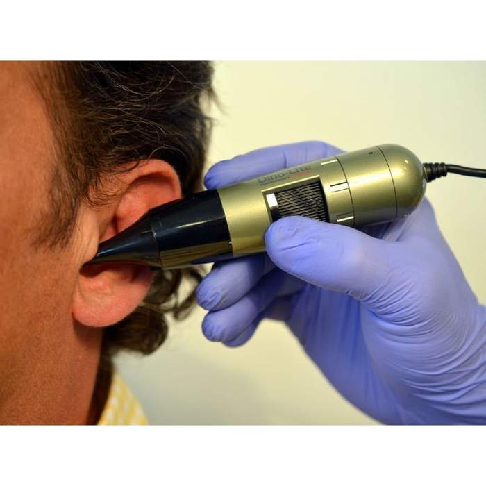Dino-Lite EarScope Pro
