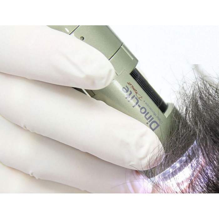 Dino-Lite TrichoScope UV